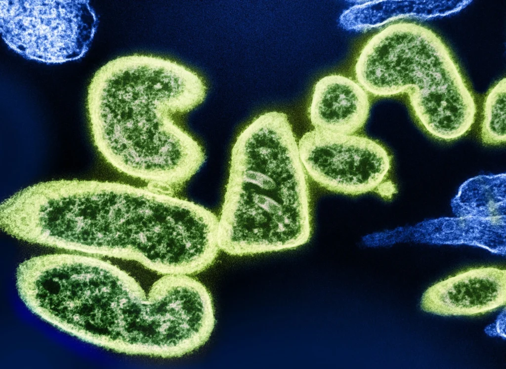 Infectious Disease medical billing